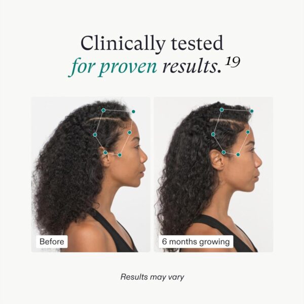 71aB6DW62sL._SL1500_.jpg Nutrafol Suplementos para el crecimiento del cabello para mujeres, para mujeres de 18 a 44 años, clínicamente probados para cabello visiblemente más grueso y fuerte, ingredientes 100% veganos,